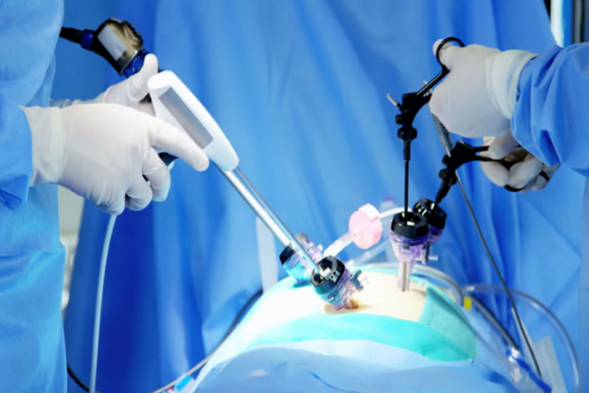 Laparoscopic Surgery